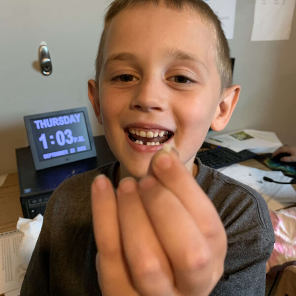 Jase lost his first tooth!
